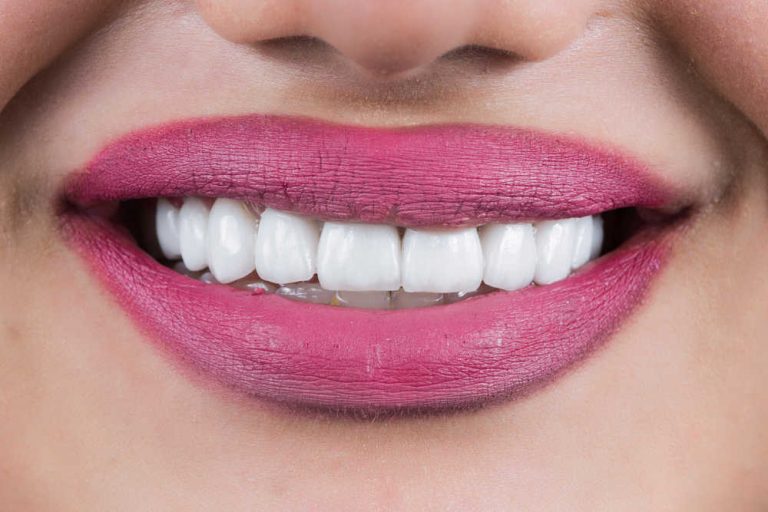 La sonrisa perfecta no existe