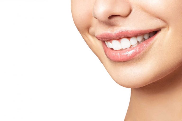 Porqué se oscurece el esmalte dental