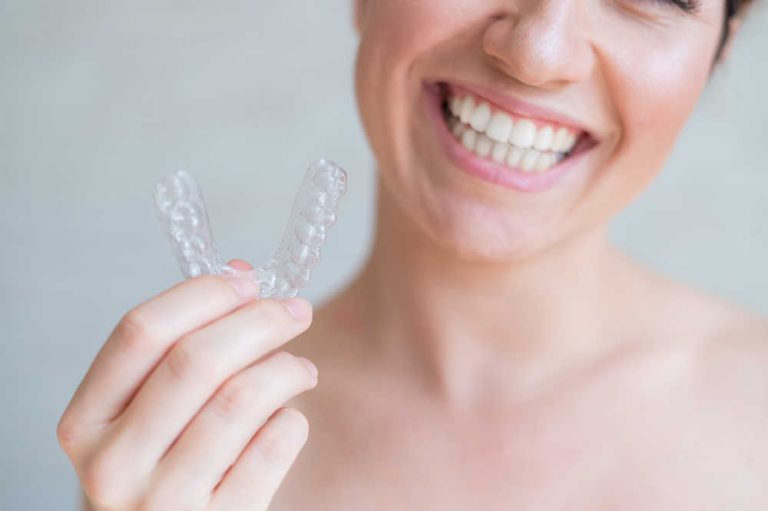 ¿Cómo cuidar tu aparato de ortodoncia invisible?